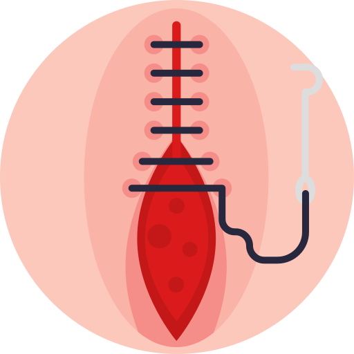 Our Services Illustration of wound suturing, representing professional GP wound management services at Al Farooq Polyclinic in Oman. Expert care for cuts, lacerations, and post-surgical wound treatment